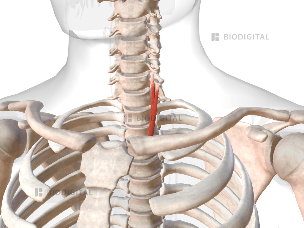 Inferior oblique part of left longus colli