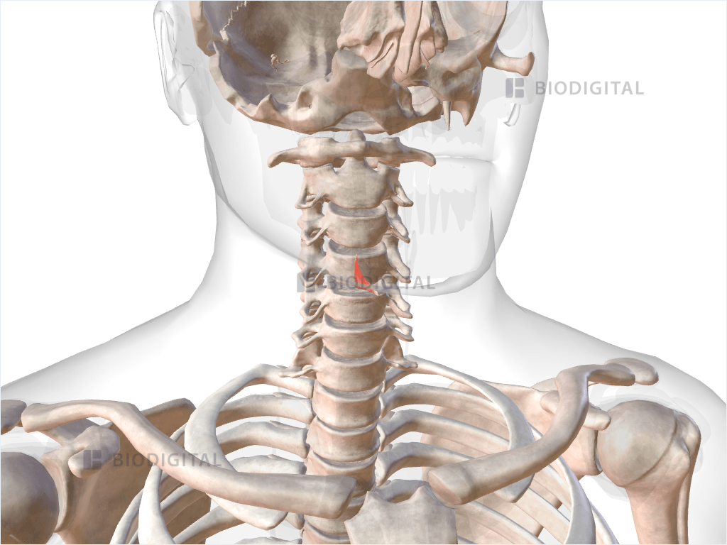 Right thyroarytenoid