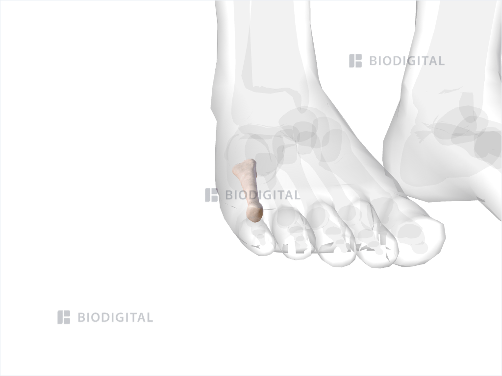 Right fifth metatarsal