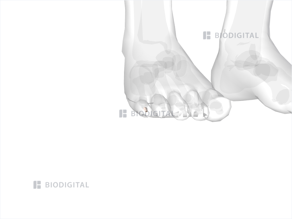 Distal phalanx of right fifth toe