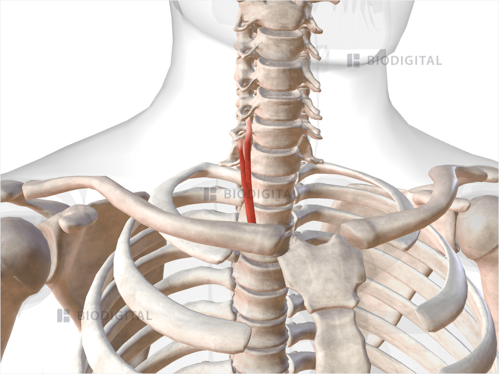 Inferior oblique part of right longus colli