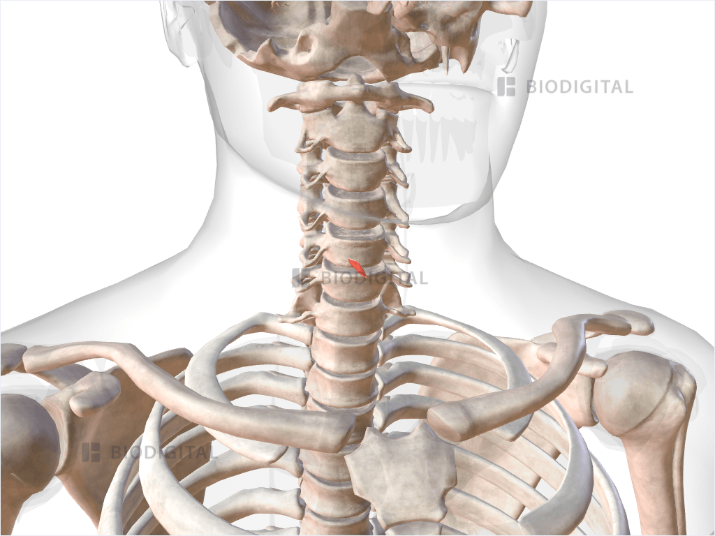 Right vertical part of cricothyroid