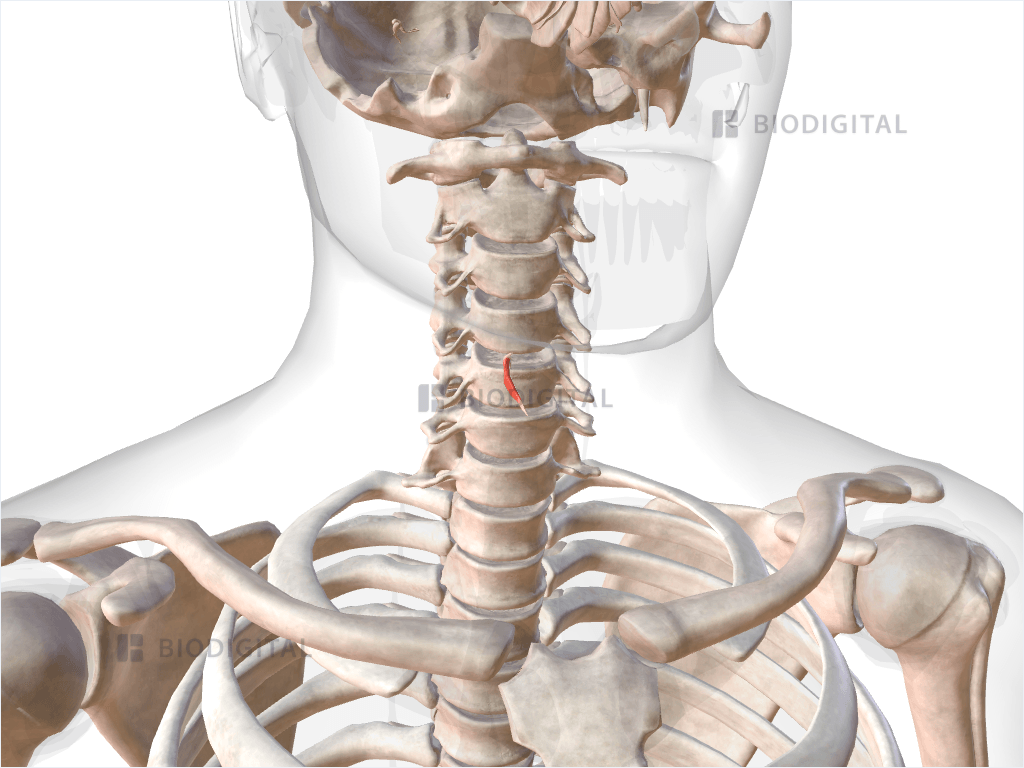 Right lateral cricoarytenoid