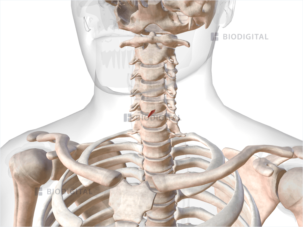 Left vertical part of cricothyroid