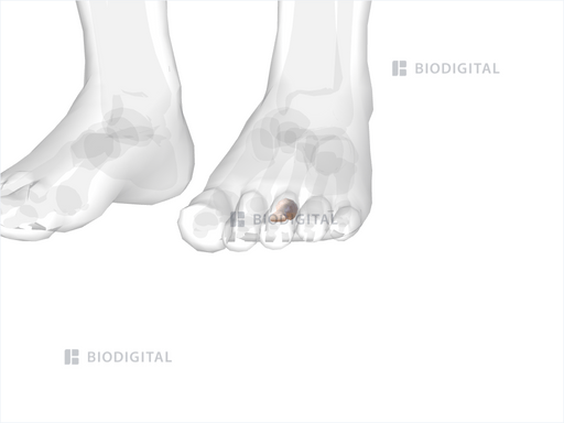 icd 10 code for left third toe proximal phalanx fracture