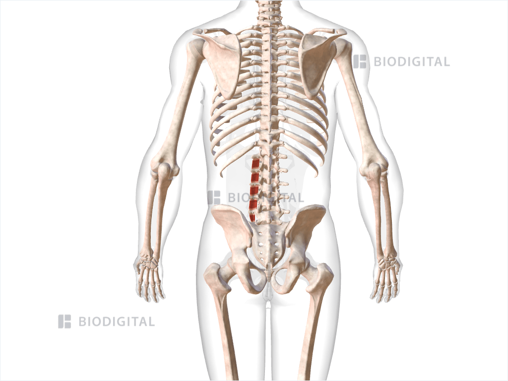 Left intertransversarii laterales lumborum