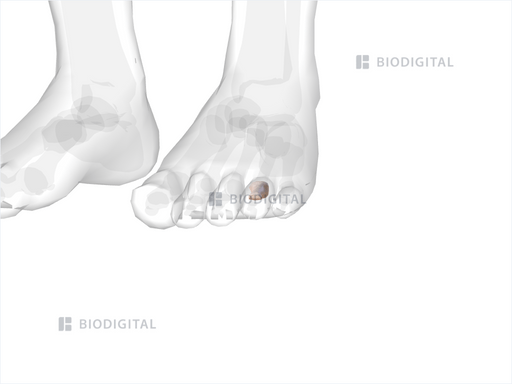 icd 10 code for left 4th toe proximal phalanx fracture