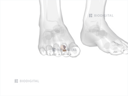icd 10 code for right 2nd toe proximal phalanx fracture