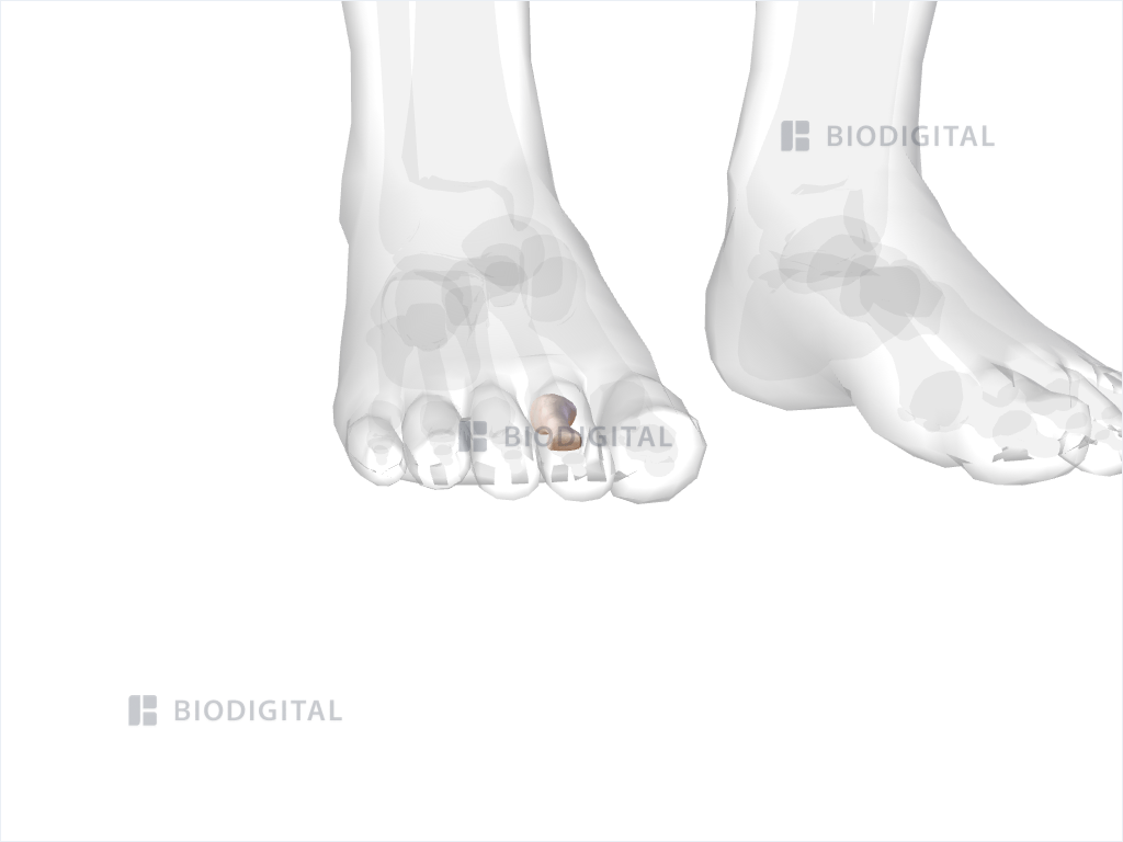 icd 10 code for right second toe proximal phalanx fracture