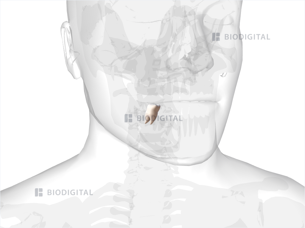 Right mandibular first molar