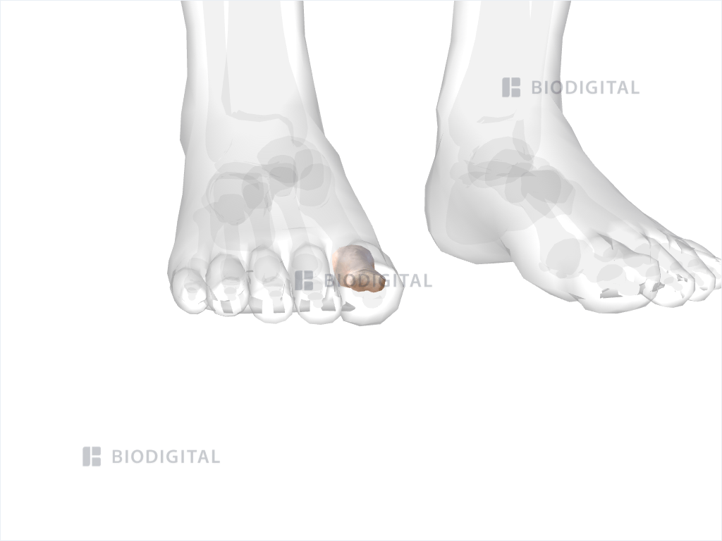 Proximal phalanx of right big toe