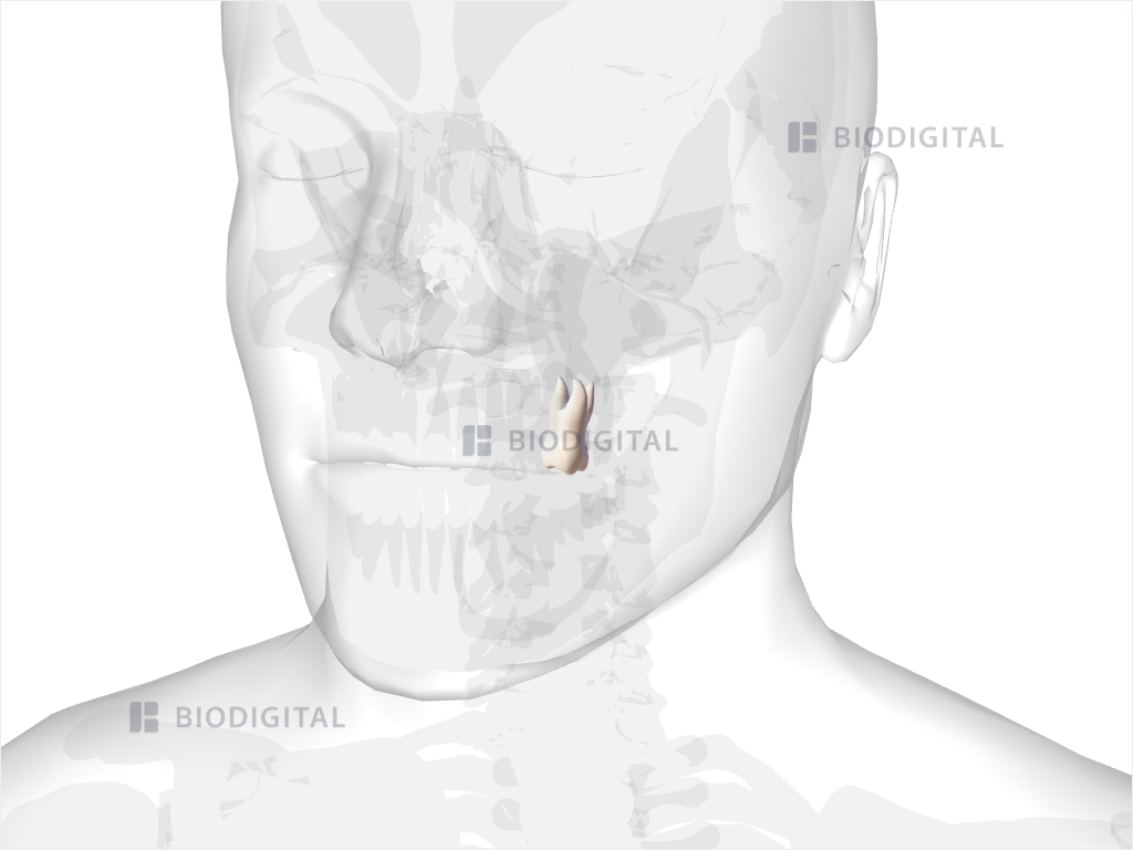 Left maxillary first molar