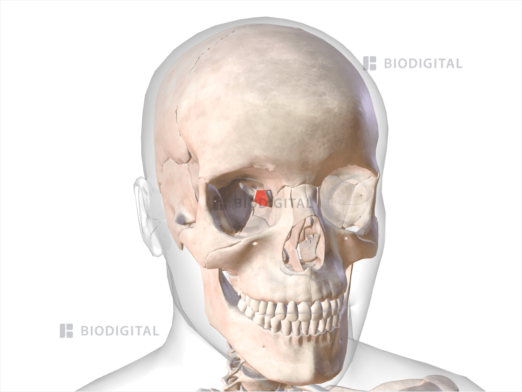 Right medial rectus