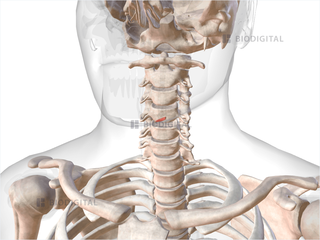 Left oblique arytenoid