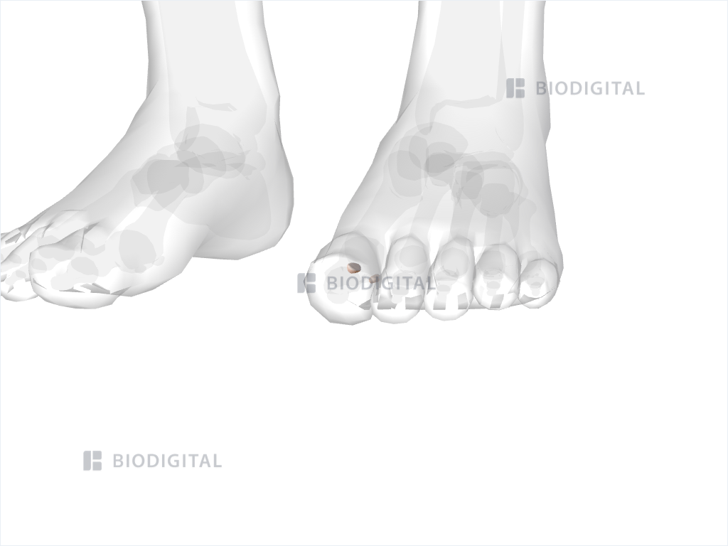 Sesamoid bones of left foot