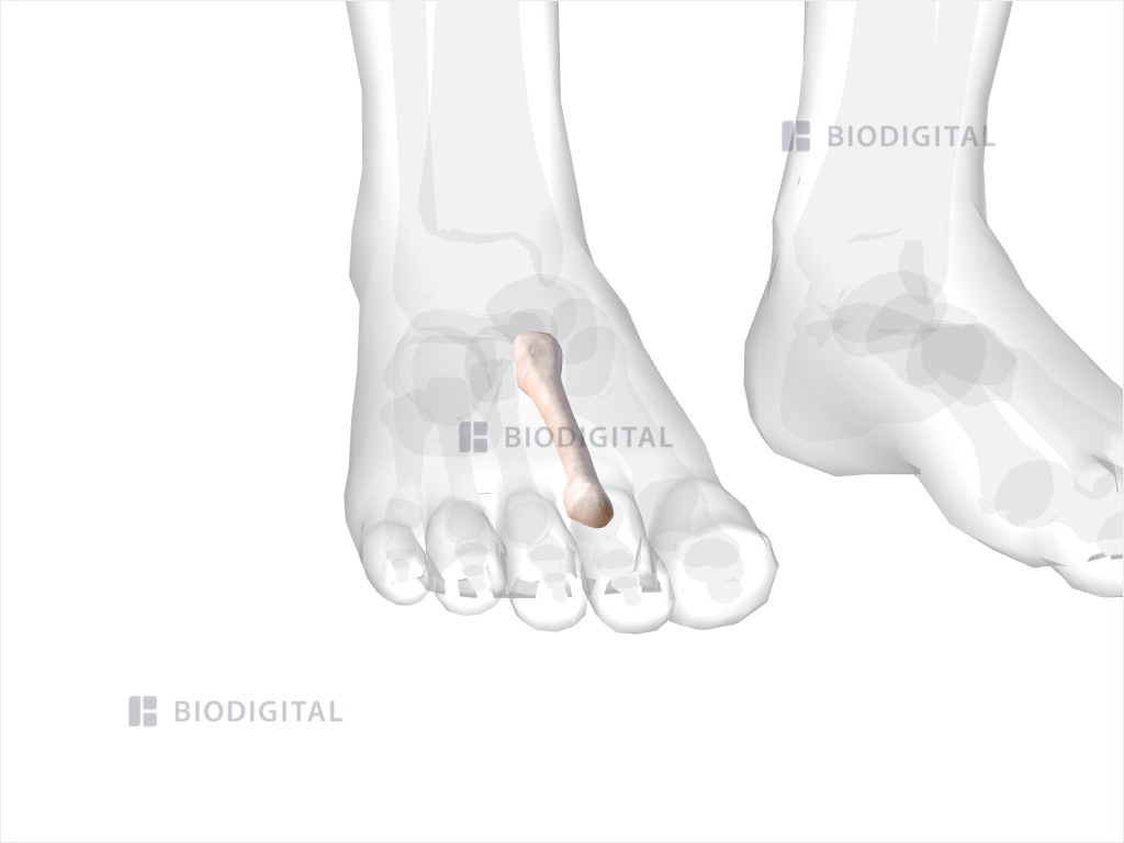 Right second metatarsal