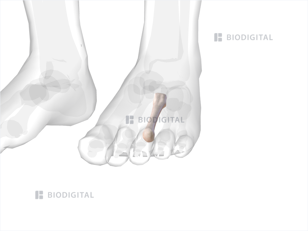 Left third metatarsal