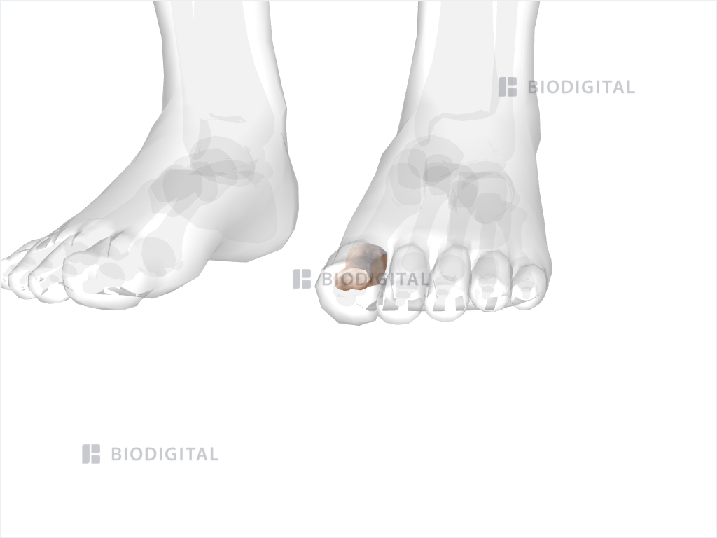 Proximal phalanx of left big toe