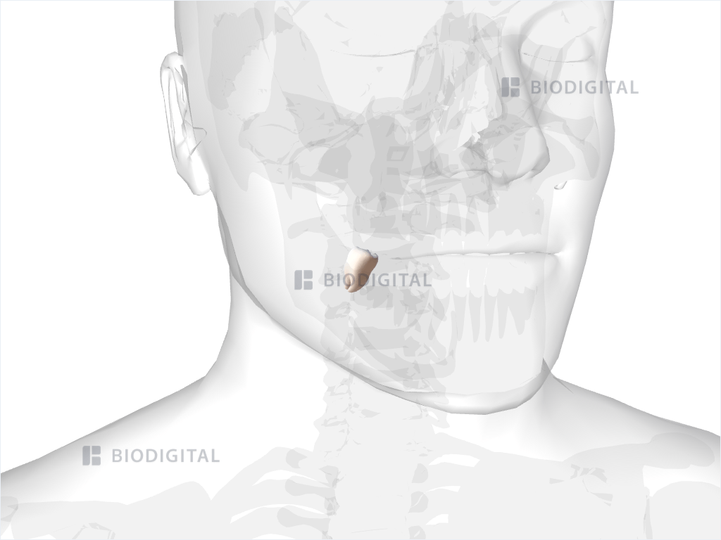 Right mandibular third molar