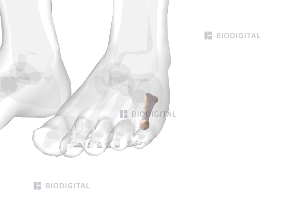 Left fifth metatarsal