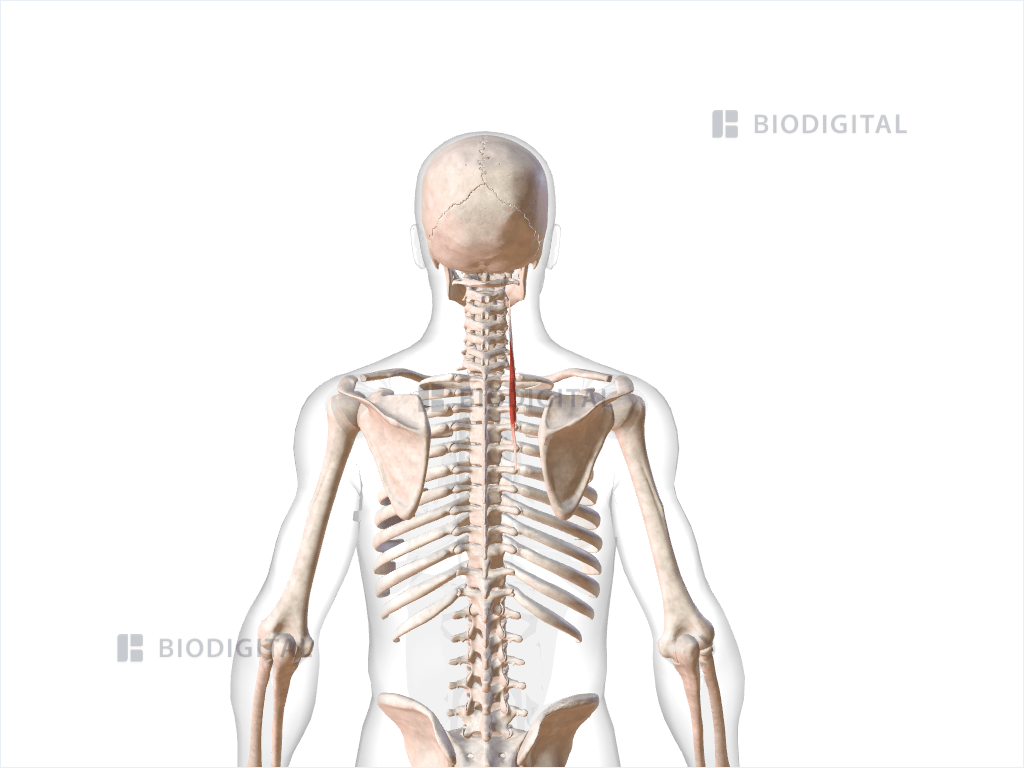 Right longissimus cervicis