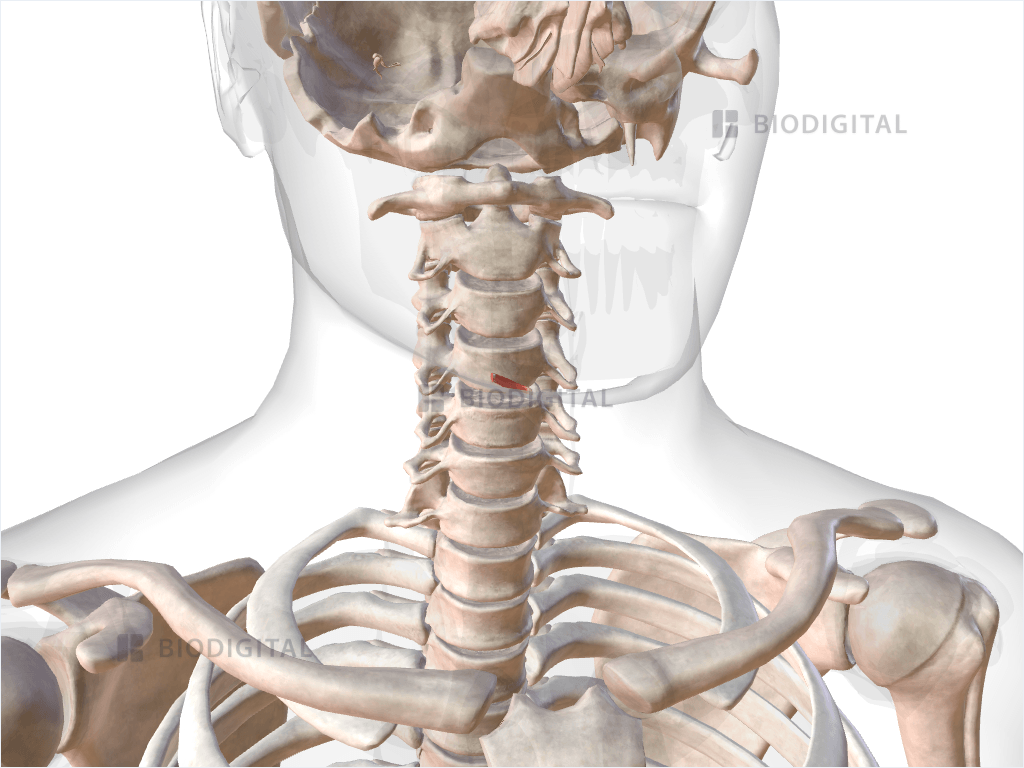 Right oblique arytenoid