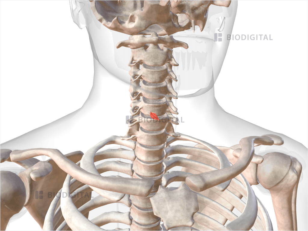 Right cricothyroid