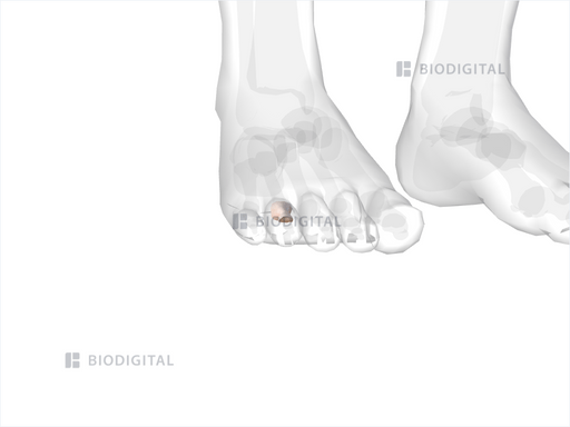 icd 10 code for right fourth toe proximal phalanx fracture