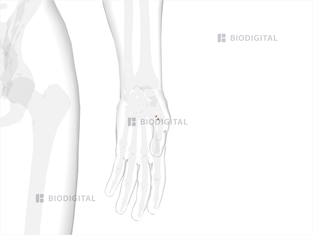 Sesamoid bones of left thumb