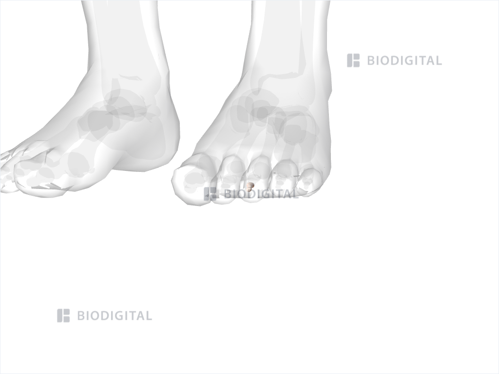 Distal phalanx of left third toe