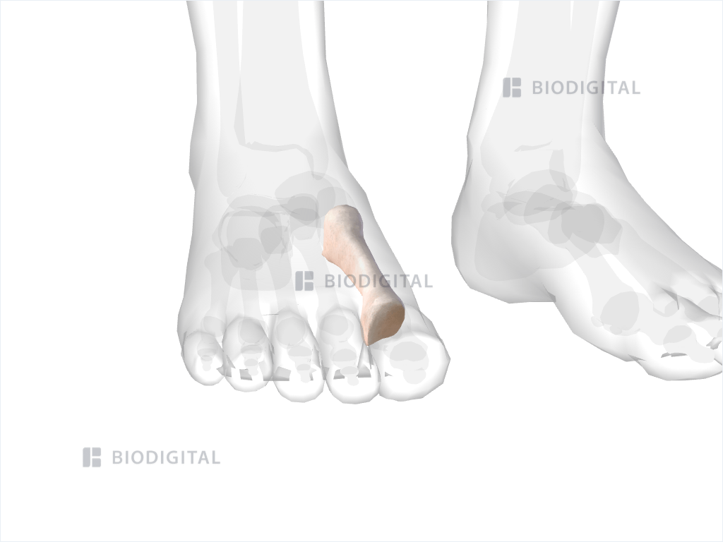 Right first metatarsal