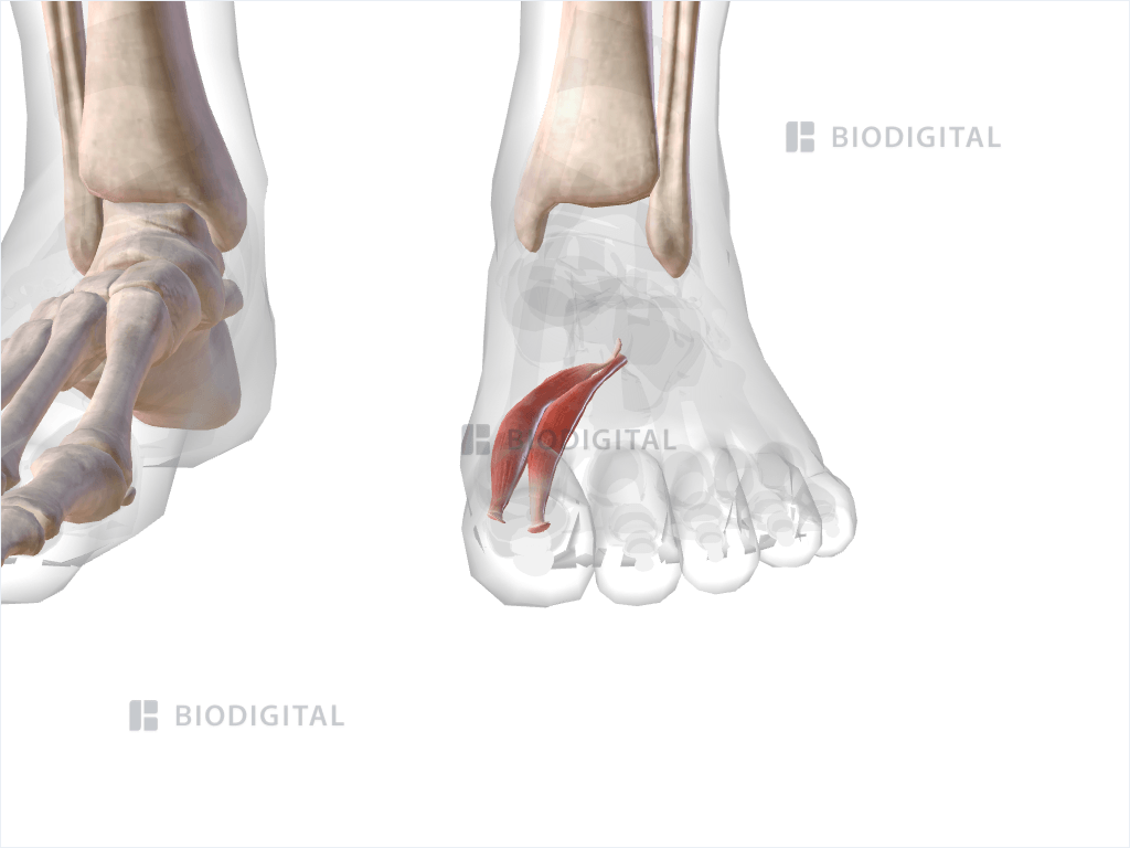 Left flexor hallucis brevis