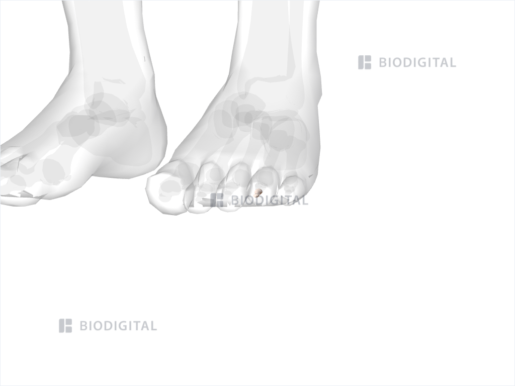 Distal phalanx of left fourth toe