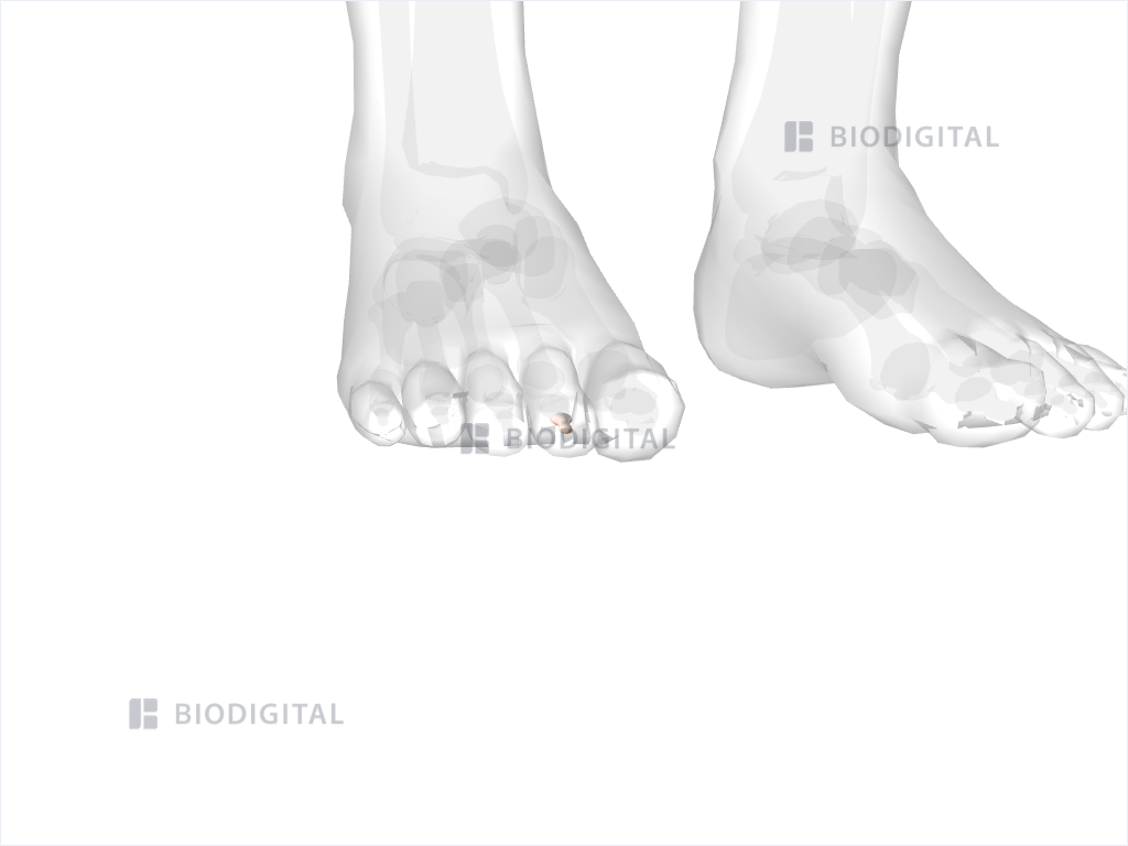 Distal phalanx of right second toe